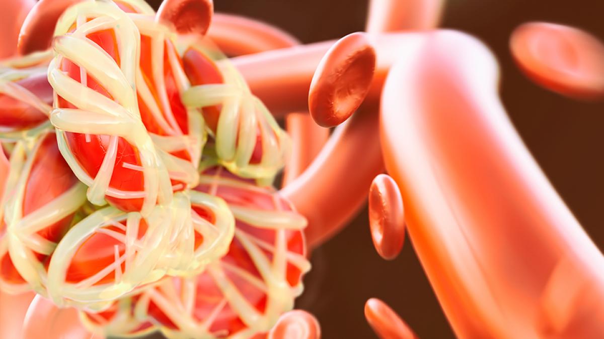 Caplacizumab dans le PTT l’objectif mortalité nulle semble