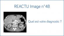 Image REACTU