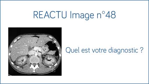 Image REACTU