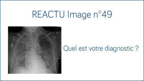 Image REACTU