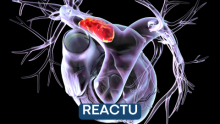reactu