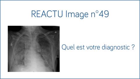 Image REACTU