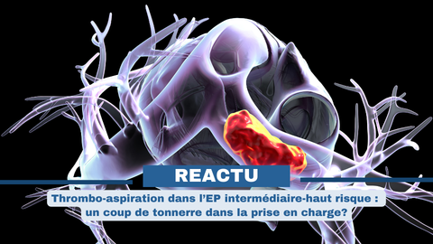 image reactu 
