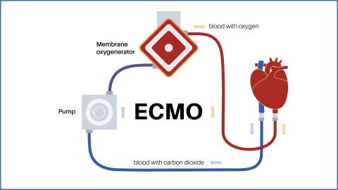 Image Webinar ECMO