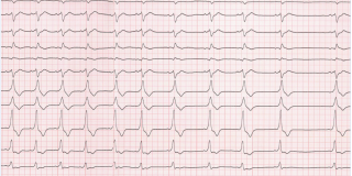 20160811-REACTU-Image-Rep_ECG3